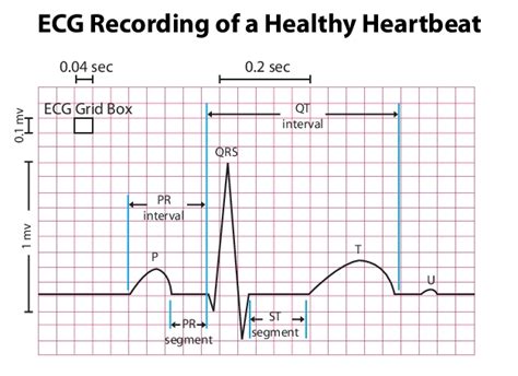 Electrocardiogram Guide (EKG/ECG) - Stepwards