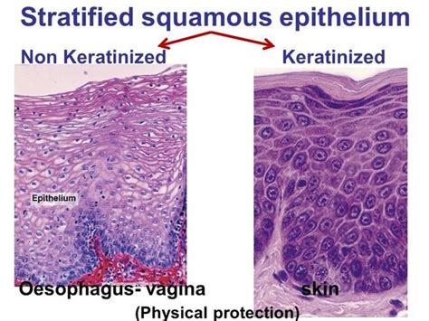 Squamous tissue in 2021 | Basic anatomy and physiology, Squamous, Stratified squamous epithelium