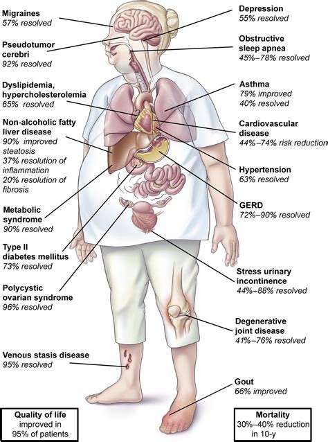 Obesity - Advanced Bariatric Surgery