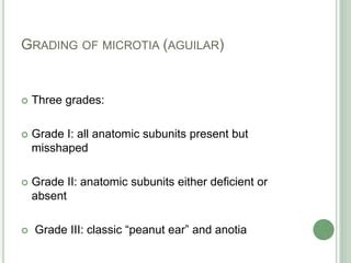 Microtia | PPT