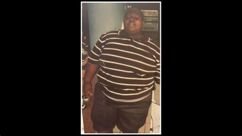 900-pound man loses half his body weight with help of minimally invasive bariatric surgery | FOX ...