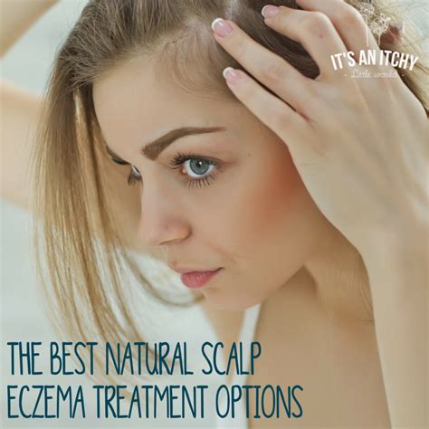 The Best Natural Scalp Eczema Treatment | It's an Itchy Little World