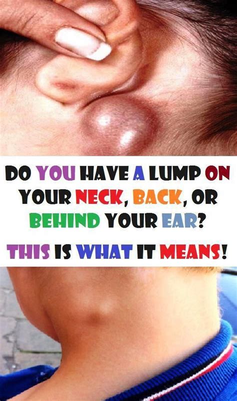 Do You have A Lump In your Neck, Back, Or Behind Your Ear? This really ...