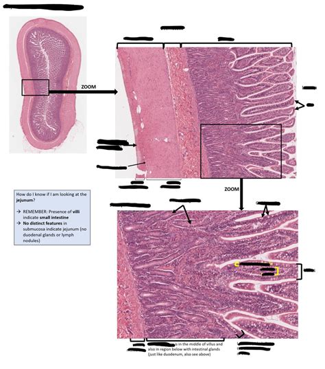 Jejunum Histology Diagram | Quizlet