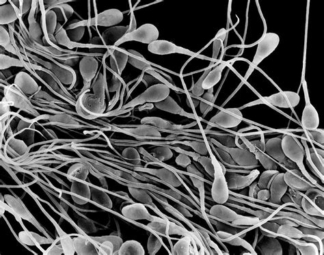 Human Sperm Photograph by Dennis Kunkel Microscopy/science Photo Library