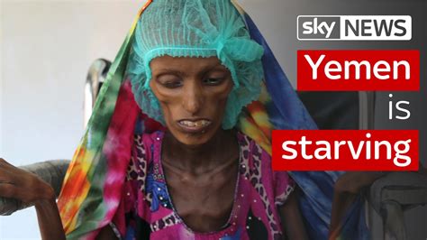 People in Yemen are starving | Scoop News | Sky News