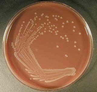 Chocolate Agar: Composition, Preparation, Uses • Microbe Online