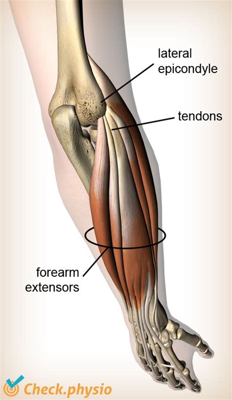 Picture Of Forearm Tendons : Massage For Arm Wrist Pain Forearm Extensors - multicuriousity-wall