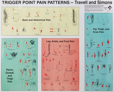 Myofascial trigger points definition, signs, symptoms, diagnosis & therapy