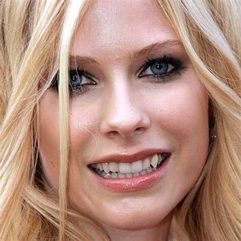 Celebrities with Bad Teeth (13 pics) - Izismile.com