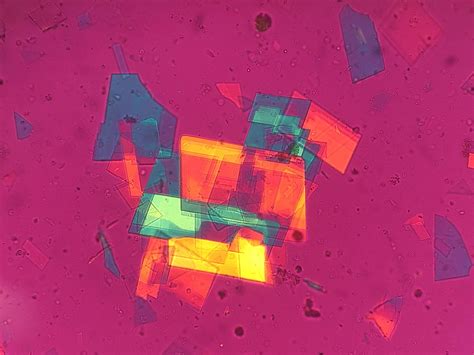 We don’t get them often in synovial fluids, but when we do...so pretty : r/medlabprofessionals