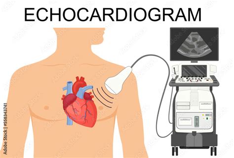 Vecteur Stock Echocardiogram. Heart ultrasound. Medical Vector illustration of Echocardiogram ...