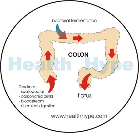 Uncontrollable Flatulence | Healthhype.com