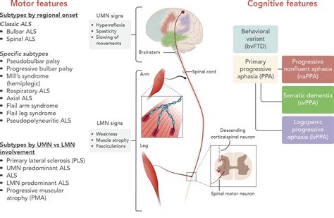 Amyotrophic lateral sclerosis: a clinical review - Masrori - 2020 ...