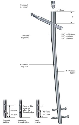 Gamma Nail Operative Technique - Nail Ftempo