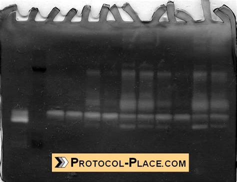 Gelatin Zymography Protocol - Protocol Place