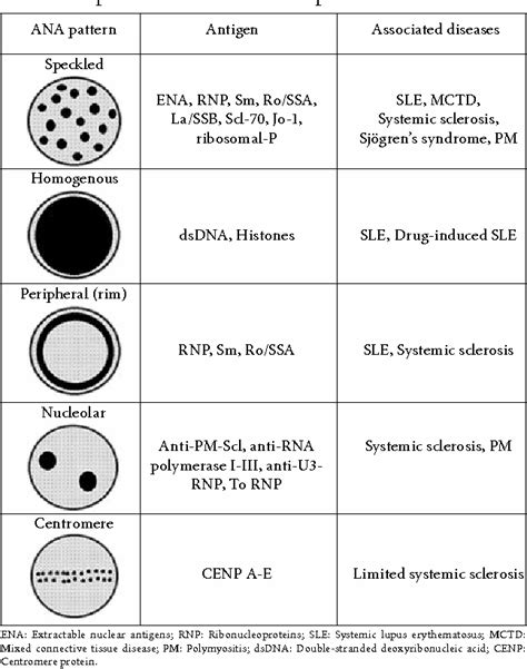 Table 1 from Diagnostic Role of Anti-Nuclear Antibodies in Rheumatic Diseases | Semantic Scholar