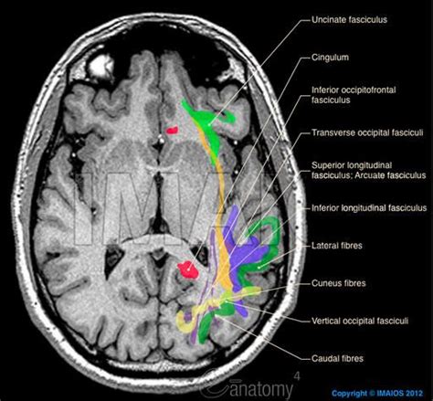 Brain: Atlas of human anatomy with MRI | Anatomy and physiology, Human ...