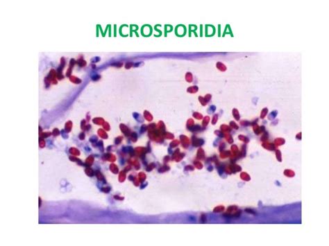 Acid fast Intestinal parasites - Parasitology isospora cyclospora - s…