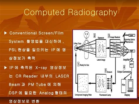 Computed radiography &digital radiography