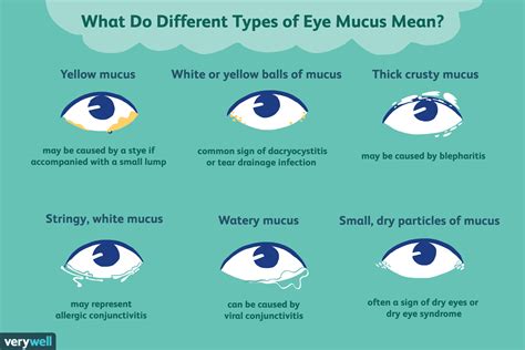 Types of Eye Mucus, Discharge, and Boogers | Types of eye, Mucus, Pink eye in toddlers