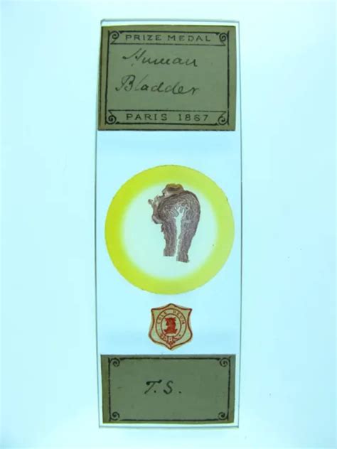 ANTIQUE MICROSCOPE SLIDE by A.C.Cole. T.S. 'Human Bladder'. $43.98 ...