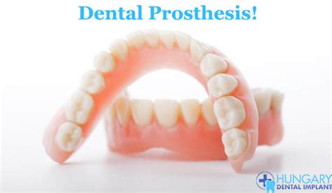 Dental Prosthesis! How it Reshape Smile - Dental Care