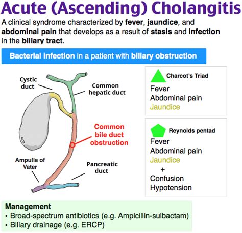 Acute (Ascending) Cholangitis Nursing Diagnosis, Nursing Study, Medical Facts, Medical ...