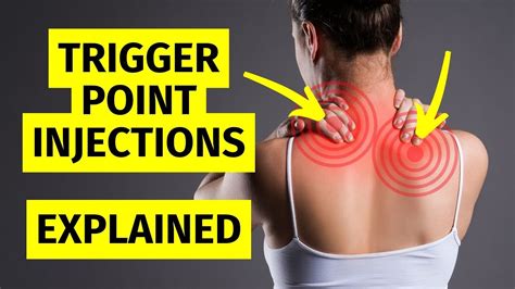 Myofascial Pain Trigger Point Injections Explained - YouTube