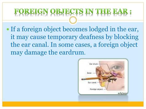 PPT - First Aid Foreign Objects Poisoning Heat Stroke PowerPoint ...