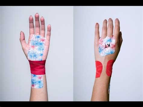 Kinesiology Taping For Carpal Tunnel Syndrome - Quotes Viral Update