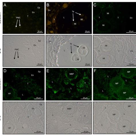 Sudan black B staining of neutral lipids in sections from olive... | Download Scientific Diagram