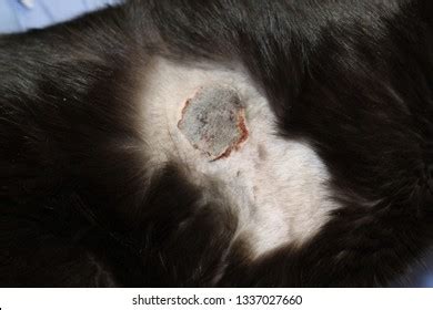 Burn Wound Eschar On Side Lateral Stock Photo 1337027660 | Shutterstock