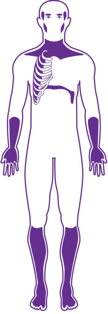 What is myotonic muscular dystrophy? - Muscular Dystrophy Queensland