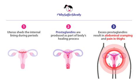 Dysmenorrhea – What It Is, Treatments, Causes – Page 4 – New Life Ticket