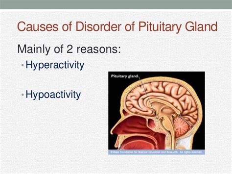 Disorders of pituitary gland