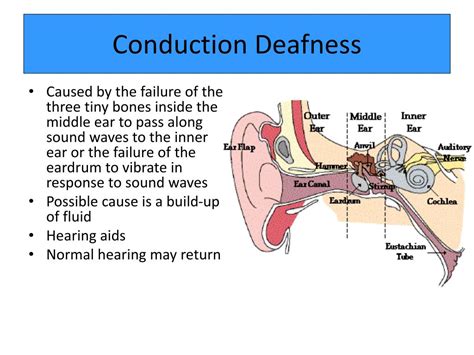 PPT - Hearing PowerPoint Presentation, free download - ID:1973793