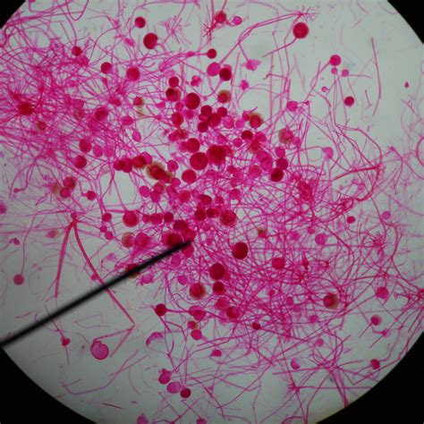 Rhizopus Stolonifer Under Microscope