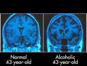 How the Weekend can Effect your Brain | SiOWfa14 Science in Our World ...