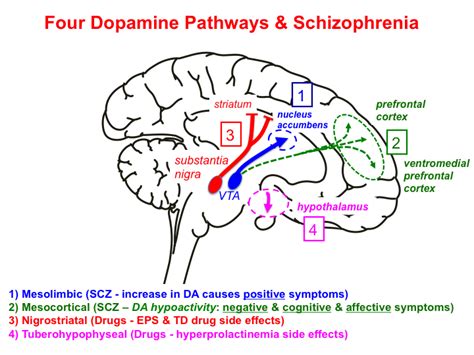 조현병 쉽게설명] 병리기전, 도파민, 항정신병약제schizophrenia- dopamine theory ...