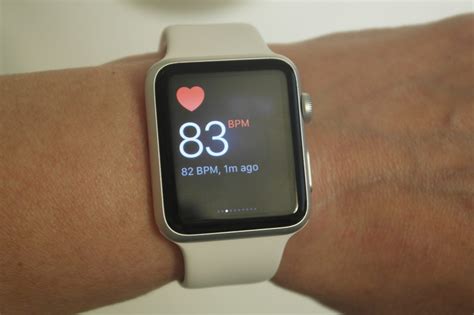 Apple Watch glucose monitoring | Diabetes Daily Forums