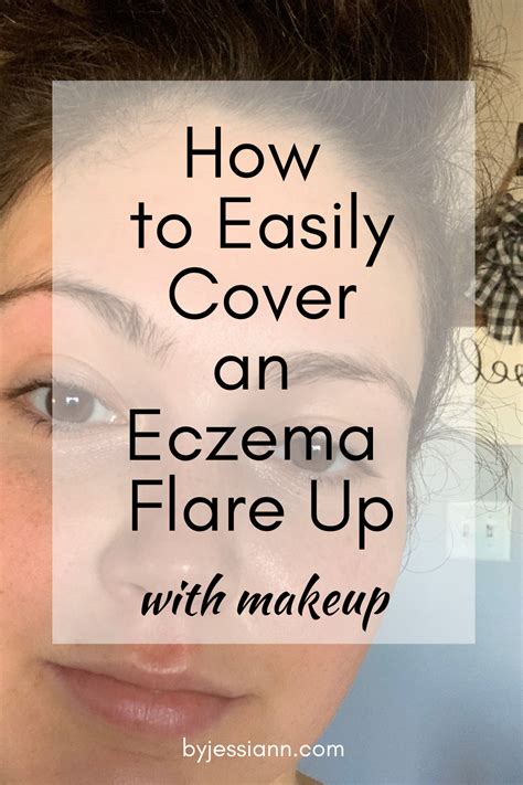 Putting makeup on eczema the ultimate guide – Artofit