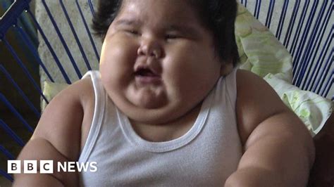 Why is this baby so overweight? - BBC News