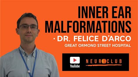 INNER EAR MALFORMATIONS || DR. FELICE D'ARCO (02/03/2021) - YouTube