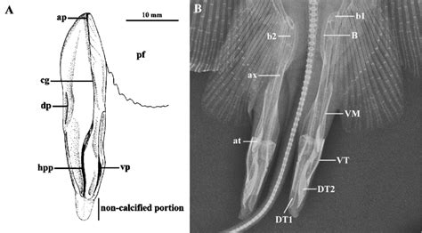 Clasper of Gymnura lessae, sp. nov. A) Illustration in dorsal view,... | Download Scientific Diagram