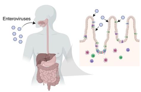 What is the Difference Between Enterovirus and Rhinovirus - Pediaa.Com