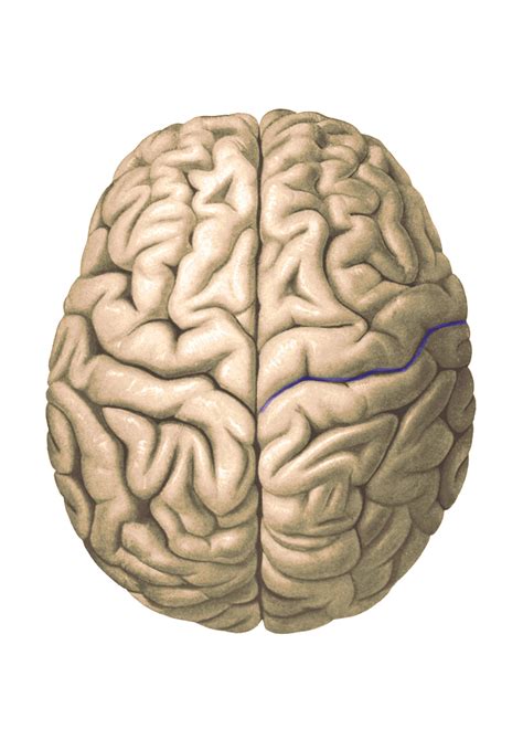 How to identify the central sulcus on a sagittal and axial MRI :-) : r/Radiology