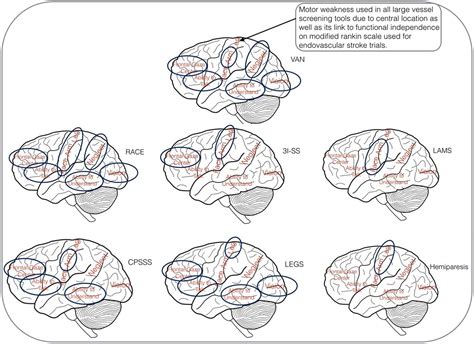 Stroke vision, aphasia, neglect (VAN) assessment—a novel emergent large vessel occlusion ...