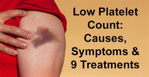 Low Platelet Count: Causes, Symptoms & 9 Treatments - David Avocado Wolfe