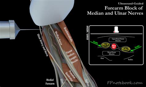 Median Nerve Forearm